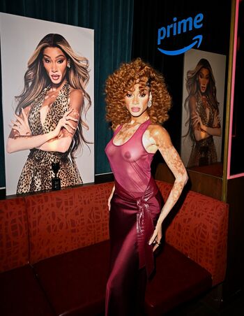 Winnie Harlow