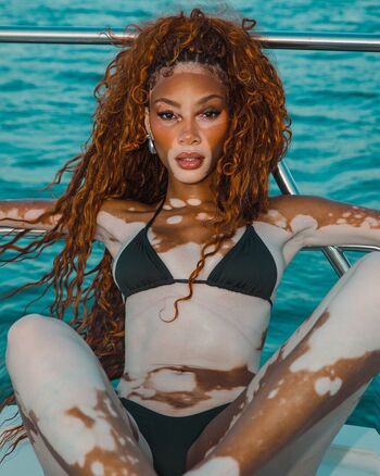 Winnie Harlow