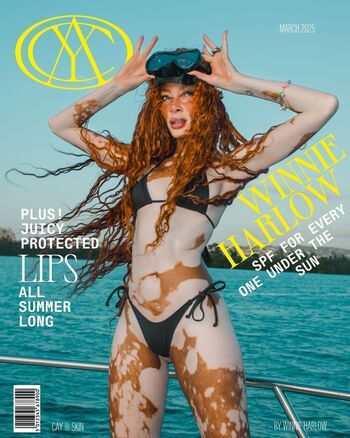 Winnie Harlow